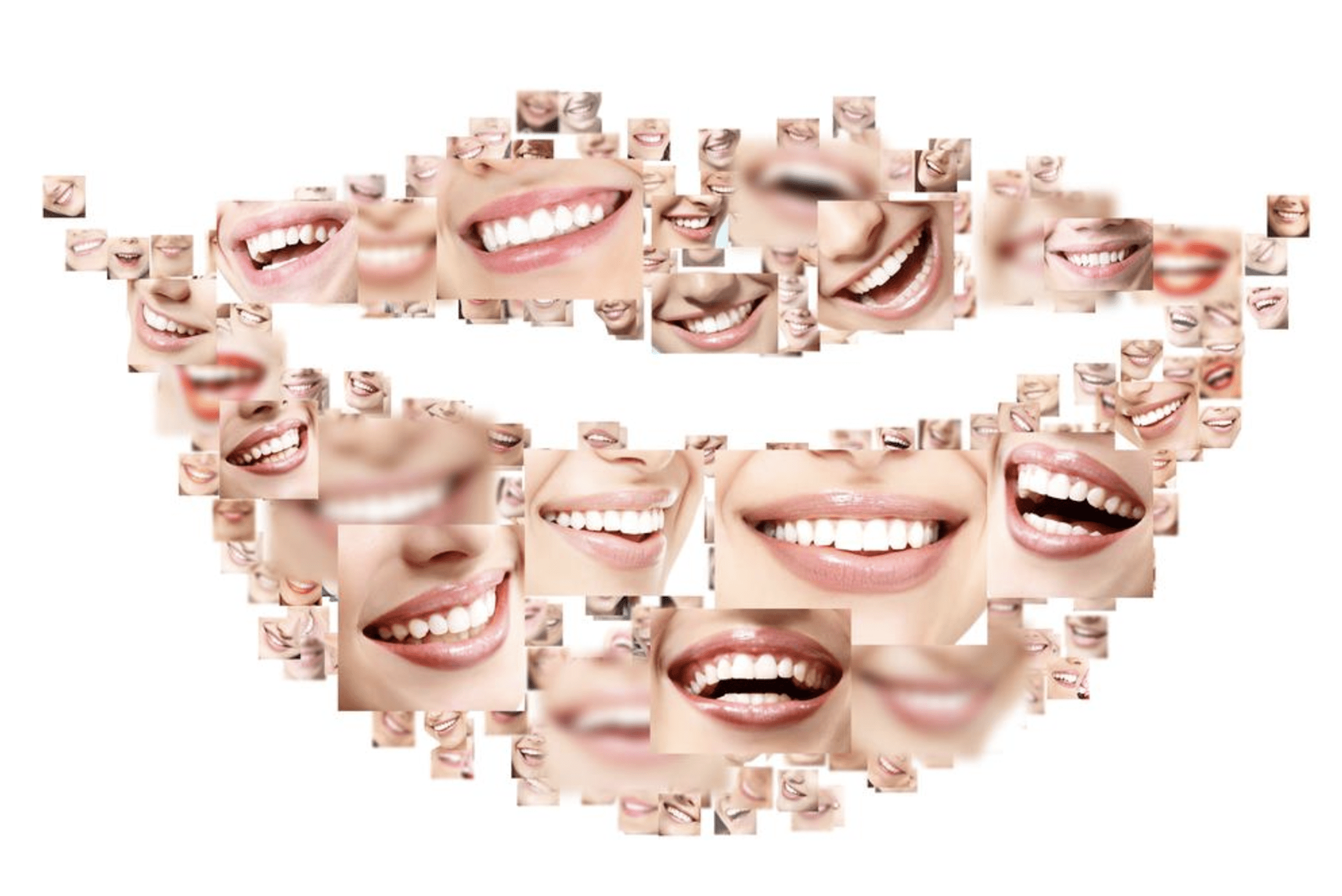 Sonreír I Aprendamos de las sonrisas ajenas clínica dental achútegui dentista2