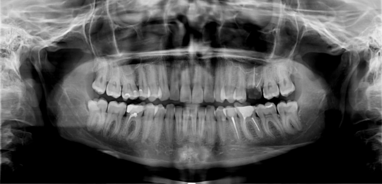 anomalia numero dientes